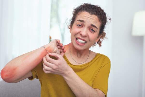 Allergic Disorder Image